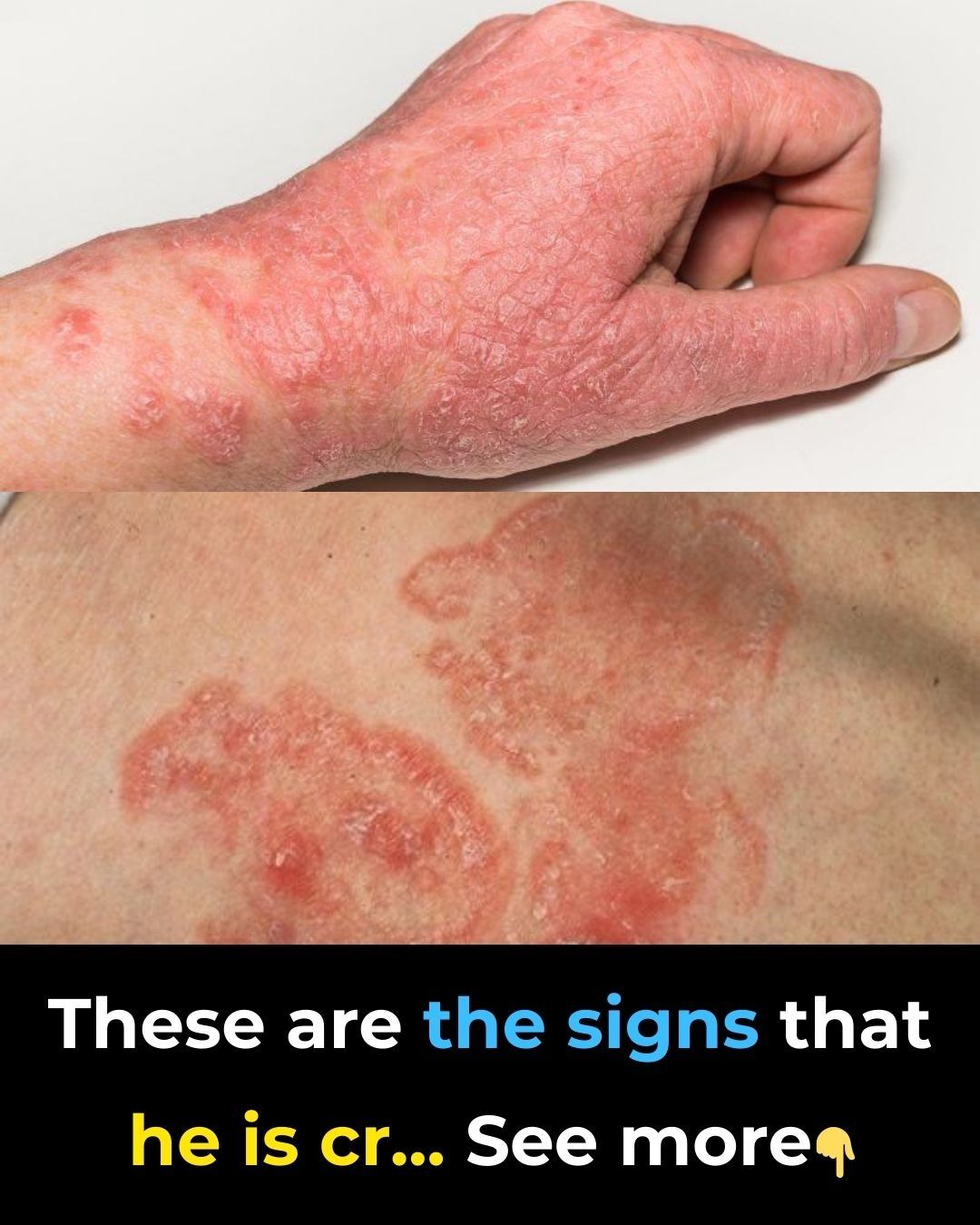 These are the signs that he is cr… See more