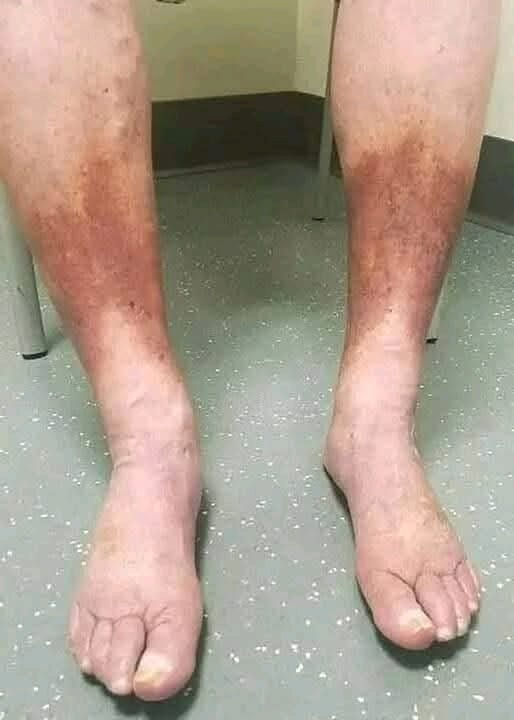 These are clear signs that he is cr… See more