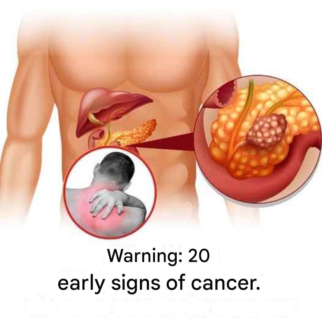 20 early signs that your body is fighting cancer